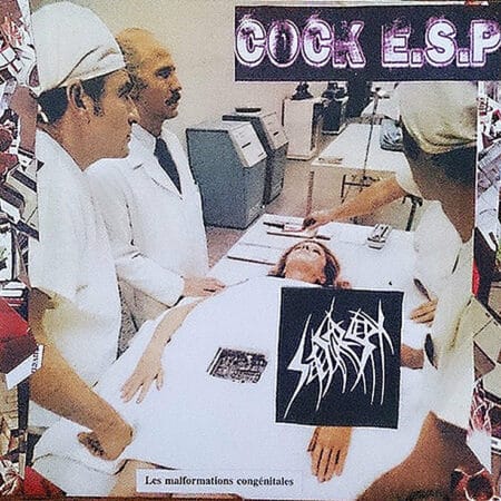 Sete Star Sept / Cock E.S.P. – Les Malformations Congénitales